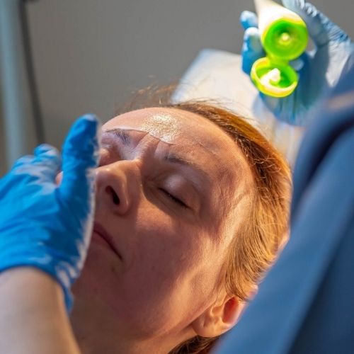 zabiegi dermapen kraków